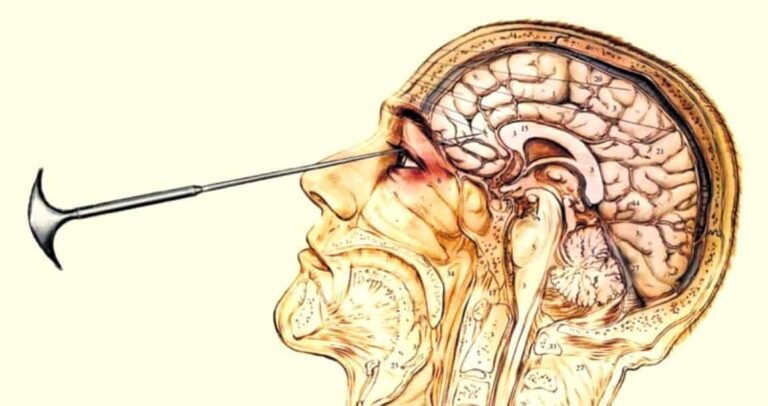 20 Medical Practices from History That Are Absolutely Bizarre